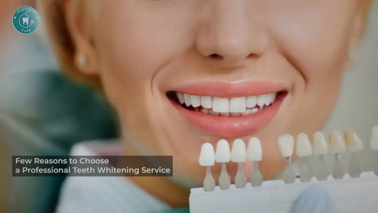 Few Reasons to Choose a Professional Teeth Whitening Service
