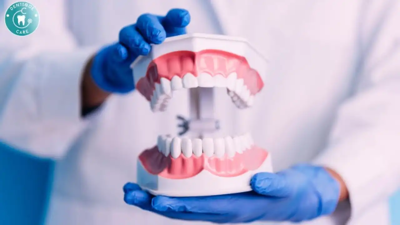 Getting Dental Implants: What to Expect?