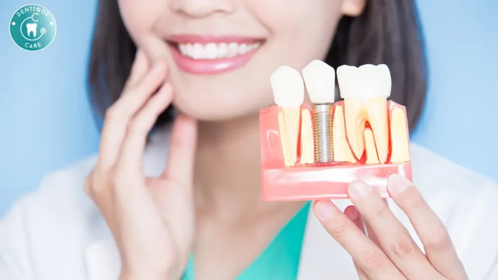What Are the Best Dental Implants? A Guide to Choosing the Right Option for You