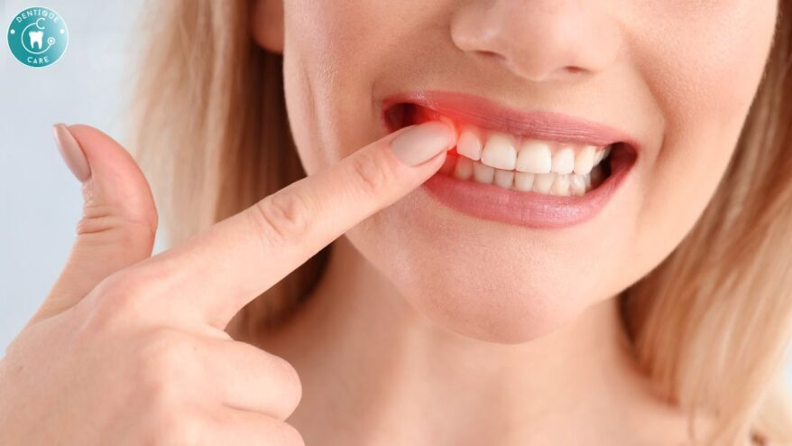 What to Do When a Toothache Strikes: Quick Home Remedies for Pain Relief